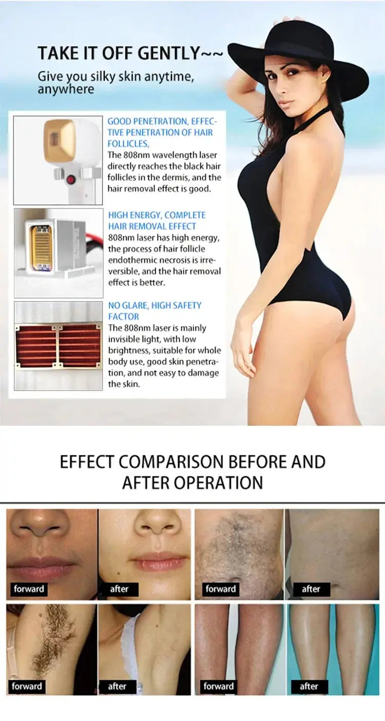 Portable Soprano 3000w Professional 808nm Diode Ice Titanium Laser Body Hair Removal Machine 2025 Smart_Life_Tech